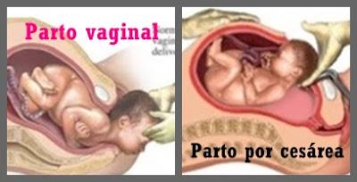 parto-vagina-o-cesarea-mimuselina
